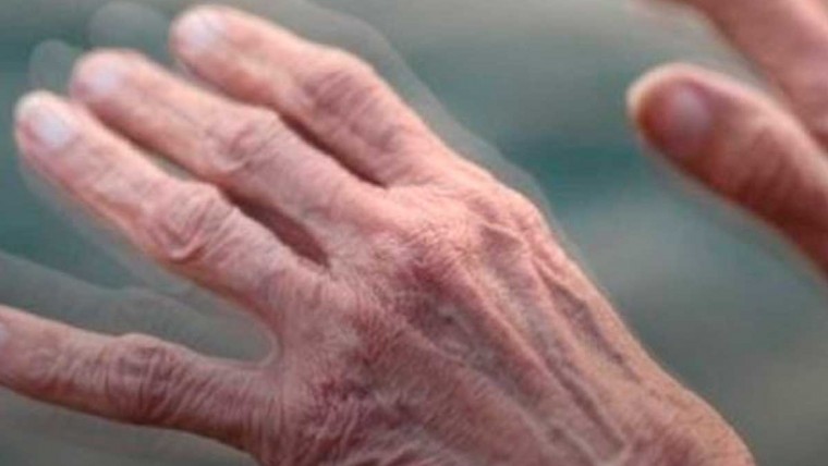 5 hábitos que ajudam quem tem o Mal de Parkinson